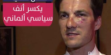 مختل عقليا"